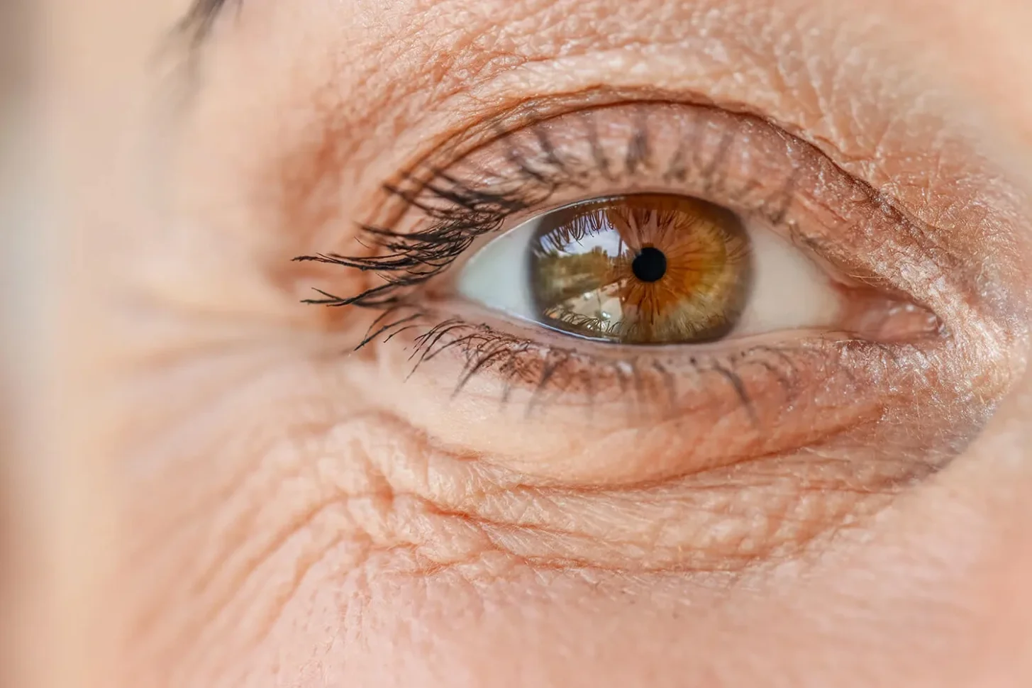 Close-up of a woman's eye – comparing cataract vs aging eye changes